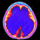 Surreal Face and Abstract Brain Illustration in Vivid Colors